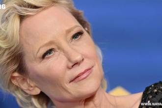 Anne Heche Autopsy Report