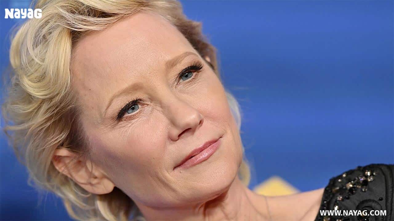 Anne Heche Autopsy Report