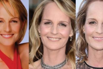 Helen Hunt Plastic Surgery