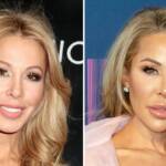 Real Housewives Of Miami Lisa Hochstein Before And After