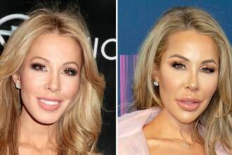 Real Housewives Of Miami Lisa Hochstein Before And After