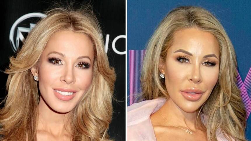 Real Housewives Of Miami Lisa Hochstein Before And After