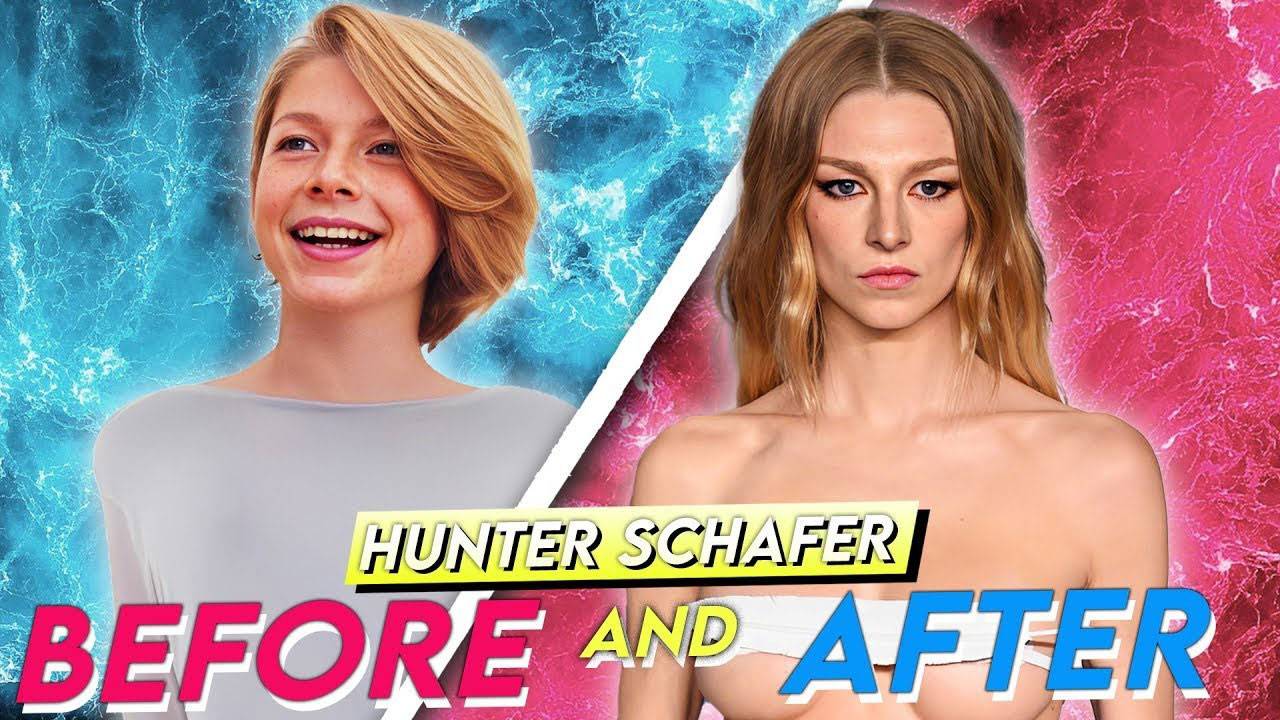 Hunter Schafer Before And After Surgery